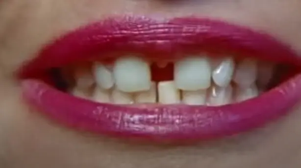 Gap-Toothed Women Screenshot